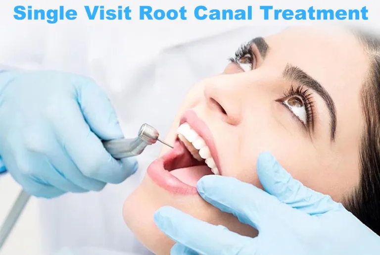 Best Root Canal Treatment In Shahibaug